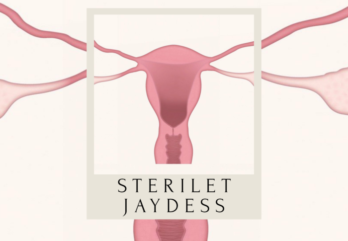 Stérilet Jaydess : mon avis et expérience