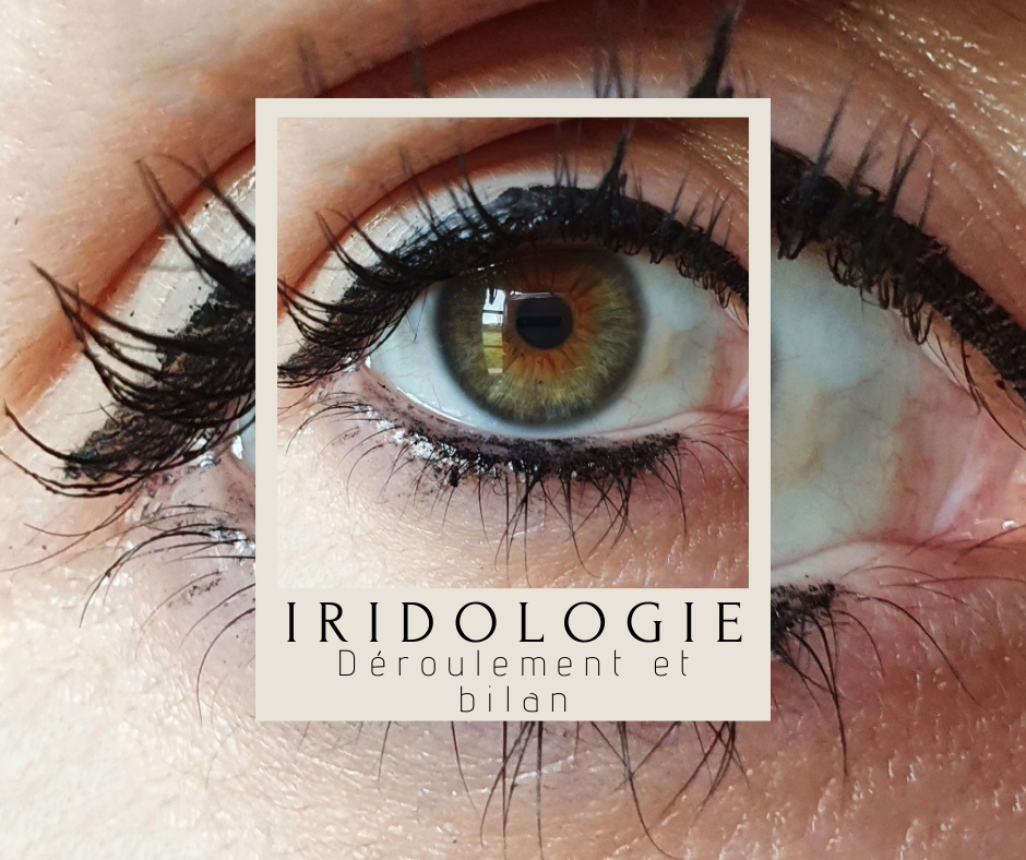 iridologie