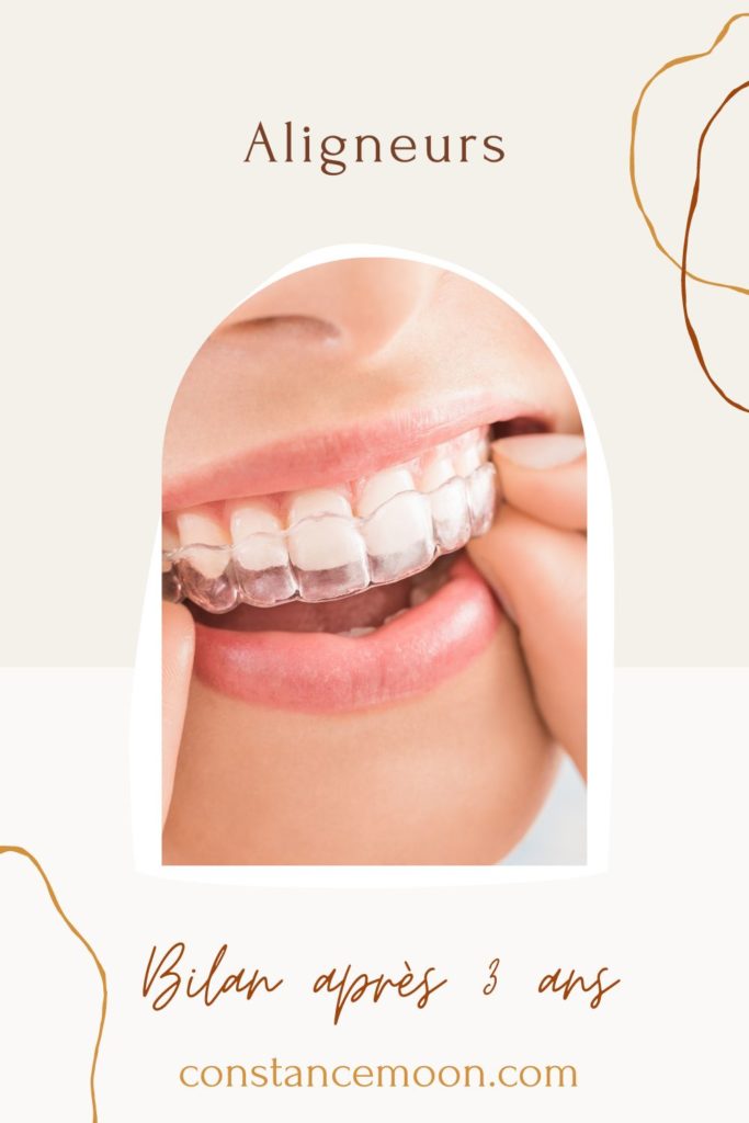 réalignement des dents avec gouttières smilers avis (1)
